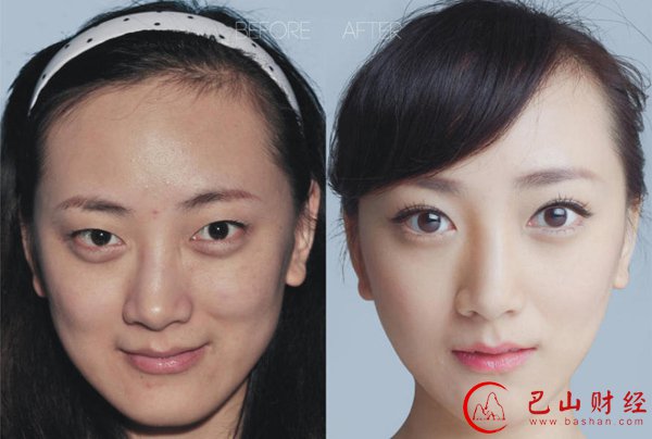 女子,整容,对比照